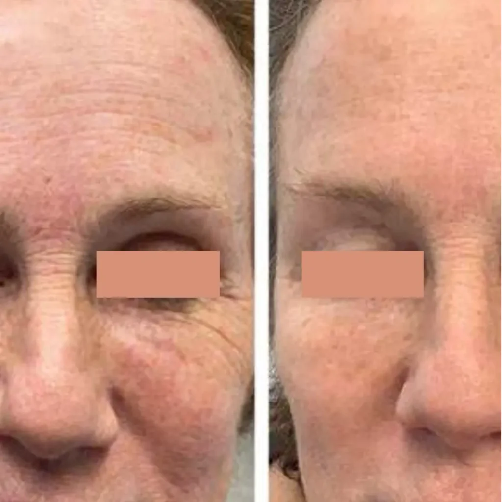 LDM Facial #1 in Houston